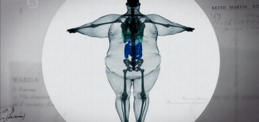 【衝撃】体重180キロの男性を透かしてみた結果がヤバい